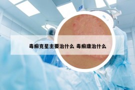 毒癣克星主要治什么 毒癣康治什么