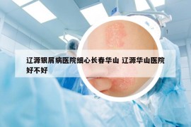 辽源银屑病医院细心长春华山 辽源华山医院好不好