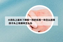 小孩头上面长了跟癣一样的东西一块怎么回事 孩子头上有癣块怎么办