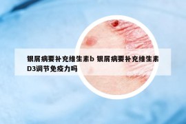 银屑病要补充维生素b 银屑病要补充维生素D3调节免疫力吗