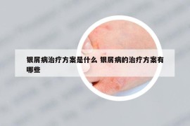 银屑病治疗方案是什么 银屑病的治疗方案有哪些