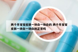 两个月宝宝皮肤一块白一块白的 两个月宝宝皮肤一块白一块白的正常吗