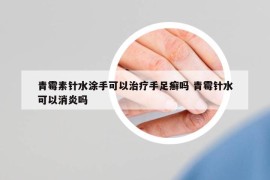 青霉素针水涂手可以治疗手足癣吗 青霉针水可以消炎吗