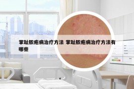 掌趾脓疱病治疗方法 掌趾脓疱病治疗方法有哪些