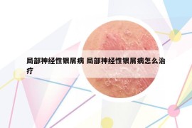 局部神经性银屑病 局部神经性银屑病怎么治疗