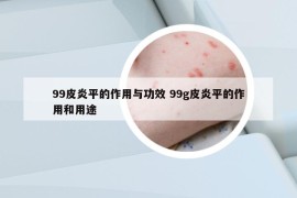 99皮炎平的作用与功效 99g皮炎平的作用和用途