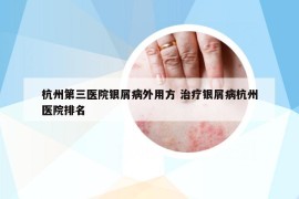 杭州第三医院银屑病外用方 治疗银屑病杭州医院排名