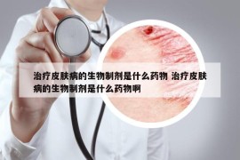 治疗皮肤病的生物制剂是什么药物 治疗皮肤病的生物制剂是什么药物啊