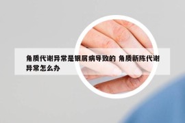 角质代谢异常是银屑病导致的 角质新陈代谢异常怎么办