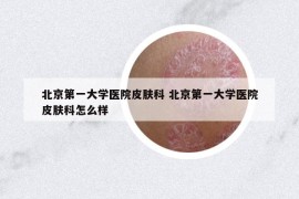 北京第一大学医院皮肤科 北京第一大学医院皮肤科怎么样