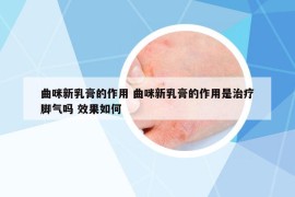 曲咪新乳膏的作用 曲咪新乳膏的作用是治疗脚气吗 效果如何