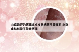 北京最好的医保定点皮肤病医院是哪家 北京皮肤科能不能走医保