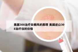 美国308治疗白癜风的原理 美国进口308治疗仪的价格