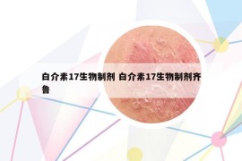 白介素17生物制剂 白介素17生物制剂齐鲁