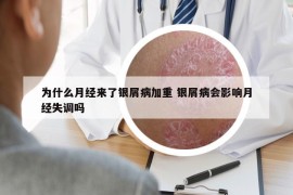 为什么月经来了银屑病加重 银屑病会影响月经失调吗