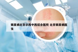 银屑病北京华西中西结合医院 北京银屑病医生