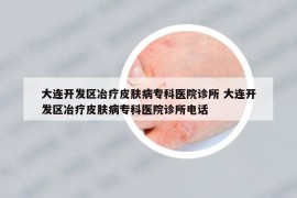 大连开发区冶疗皮肤病专科医院诊所 大连开发区冶疗皮肤病专科医院诊所电话