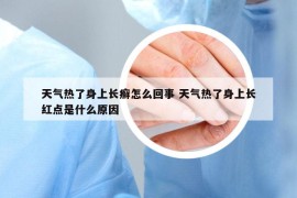 天气热了身上长癣怎么回事 天气热了身上长红点是什么原因