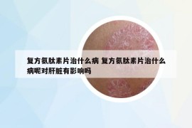 复方氨肽素片治什么病 复方氨肽素片治什么病呢对肝脏有影响吗