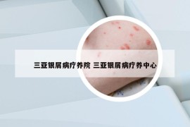 三亚银屑病疗养院 三亚银屑病疗养中心