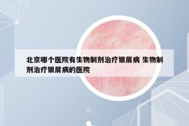 北京哪个医院有生物制剂治疗银屑病 生物制剂治疗银屑病的医院