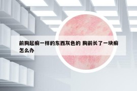 前胸起癣一样的东西灰色的 胸前长了一块癣怎么办