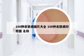 100种皮肤病图片大全 100种皮肤病对照图 名称