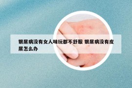 银屑病没有女人味玩都不舒服 银屑病没有皮屑怎么办