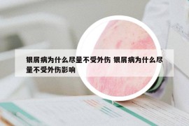 银屑病为什么尽量不受外伤 银屑病为什么尽量不受外伤影响