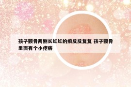 孩子颧骨两侧长红红的癣反反复复 孩子颧骨里面有个小疙瘩