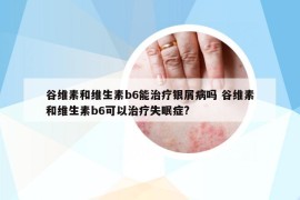 谷维素和维生素b6能治疗银屑病吗 谷维素和维生素b6可以治疗失眠症?