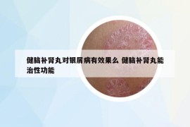 健脑补肾丸对银屑病有效果么 健脑补肾丸能治性功能