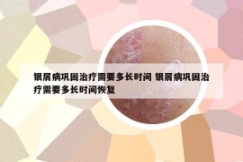 银屑病巩固治疗需要多长时间 银屑病巩固治疗需要多长时间恢复