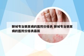 聊城专治银屑病的医院价格表 聊城专治银屑病的医院价格表最新