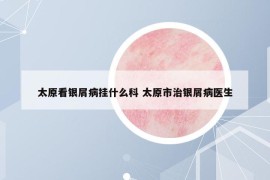 太原看银屑病挂什么科 太原市治银屑病医生