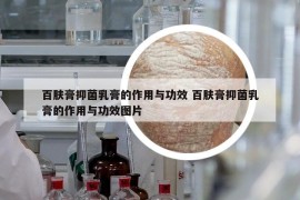 百肤膏抑菌乳膏的作用与功效 百肤膏抑菌乳膏的作用与功效图片