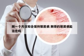 刚一个月该如合保持银屑病 刚得的银屑病能治愈吗