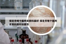 保定市哪个医院皮肤科最好 保定市哪个医院皮肤科最好的医生