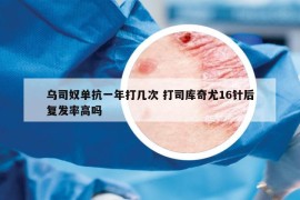 乌司奴单抗一年打几次 打司库奇尤16针后复发率高吗