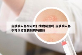 皮肤病人怀孕可以打生物制剂吗 皮肤病人怀孕可以打生物制剂吗视频