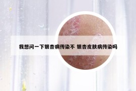 我想问一下银杏病传染不 银杏皮肤病传染吗