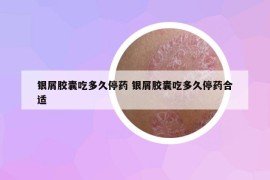 银屑胶囊吃多久停药 银屑胶囊吃多久停药合适