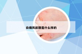 白癜风前期是什么样的