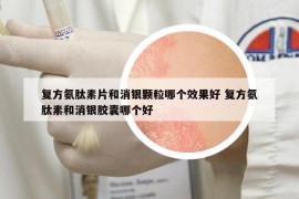 复方氨肽素片和消银颗粒哪个效果好 复方氨肽素和消银胶囊哪个好