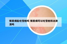 银屑病能吃雪糕吗 银屑病可以吃雪糕和冰激凌吗