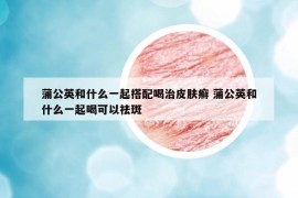 蒲公英和什么一起搭配喝治皮肤癣 蒲公英和什么一起喝可以祛斑