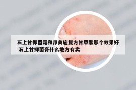 石上甘抑菌霜和邦美施复方甘草酸那个效果好 石上甘抑菌膏什么地方有卖