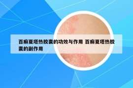 百癣夏塔热胶囊的功效与作用 百癣夏塔热胶囊的副作用