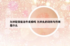 九妙轻膏能治牛皮癣吗 九妙丸的功效与作用是什么