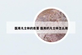 医用凡士林的危害 医用的凡士林怎么用